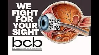 Eye Problems? See This: Floaters, Cataracts, Pressure Drops!