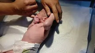 Initial Newborn Assessment: Perineal Examination and Random Blood Sugar (RBS) Screening.
