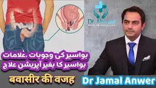 piles | Hemorrhoids | Bawaseer | bleeding per rectum | بواسیر کا بغیر آپریشن علاج बवासीर का इलाज