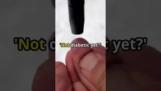 Prediabetes Signs You Should Never Ignore (Already Progressing!) #healthtips #facts #food