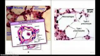 PNEUMOCYTES : PG 559 FA 12