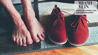 Varicose Veins in the Feet Miami Vein Center