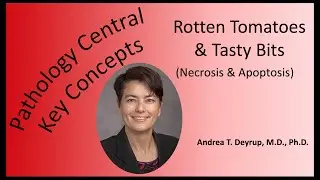 Pathology Central Key Concepts: Rotten Tomatoes & Tasty Bits (Necrosis & Apoptosis)