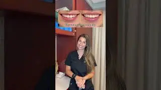 How to know you may need a lip flip 💖 #lipflip #botox