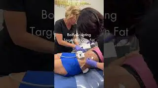 Melt Stubborn Fat with TruSculpt | Non-Invasive Body Sculpting in Milwaukee