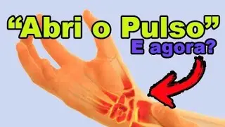 Abri o Pulso? Dor no Punho? Descubra as Causas, Tratamentos e Como Aliviar!