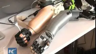 New low-cost 3D-print limbs to bring amputees back to normal life