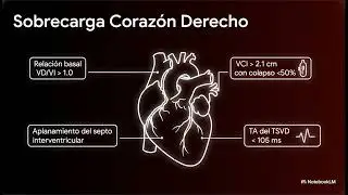 Un poco de &hellip;Echocardiographic Hemodynamic Assessment: A Bedside Consensus Statement