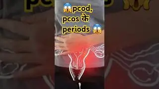 😱#pcod, pcos k periods😱 #pcod #pcos #hormonal problems #infrtility #ytshorts #shortfeed  #viral