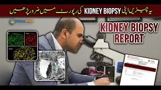 Kidney Biopsy Report May Yeh Cheezain Zaror Parrhain | Episode 84