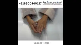 Silicone cosmetic finger#artificiallimbcenter #cosmetic restoration #prosthetics #nakliungli