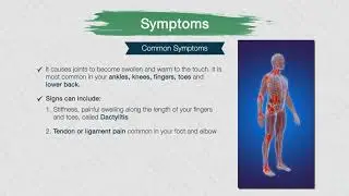 Psoriatic Arthritis Part 1