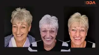 Facially Driven Implantology with MODJAW, CEREC & Ackuretta