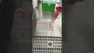 Wenn KI meinen Job &uuml;bernimmt, dann bitte inklusive Kontamination, Pipettierfehlern und