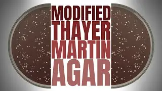 Modified Thayer Martin Agar: Composition, Preparation, Principle, Results & Uses | Culture Media