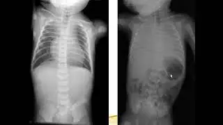 08 ERIC Pediatric (Non Trauma - Emergency Imaging)