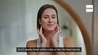Microneedling Treatment in Dallas, TX: How Long to See Results?