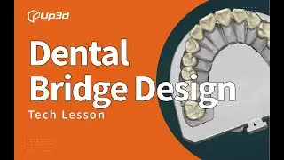 Dental Bridge Design「UP3D Tech Lesson」