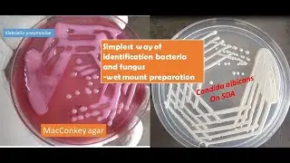 A very simple Saline  wet mount techniue help you to identify  yeast cells of candida from bacteria
