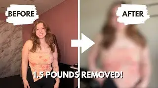 How My Clothes Fit After Breast Reduction | Before & After Try-On