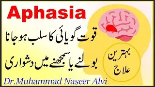 Aphasia causes, symptoms and treatment | Crotalus horridus
