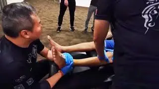 Throwback year 2019- CLM Tit Tar Adjustment for patients ankle injury due to motorbike accidents.