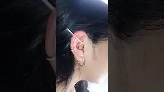 aplicaci&oacute;n de helix con arete en titanium