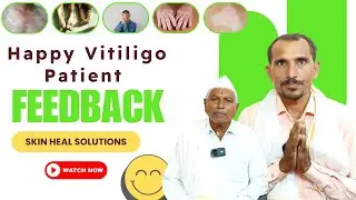Happy Vitiligo Patient Feedback | Dr. Neha Dongaonkar | Skin Heal Solutions