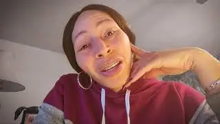 My late 10 month update on the braces journey - Adult braces