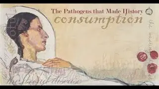Historical names of Tuberculosis; Consumption, Wasting disease, White plague, King&rsquo;s Evil