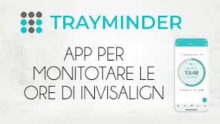 App TrayMinder per monitorare le ore di Invisalign
