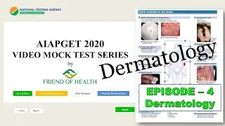 AIAPGET 2020 Video Mock Test Series | Real Exam Screen | Dermatology 10 IMPORTANT MCQ's | Episode 4