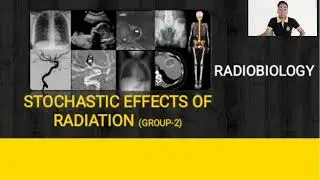 STOCHASTIC EFFECT OF RADIATION