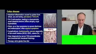 Session sneak peek: Oral inhibitor of tissue transglutaminase prevents mucosal damage