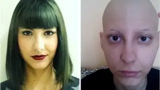 Cáncer y pérdida del cabello: Pañuelos, pelucas y gorros