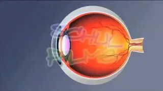 Lernvideo: Optische Ger&auml;te: Brille, Lupe und Mikroskop  Download
