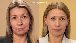 BABOR_MY SKIN, MY STORY: Что делать, если кожа постоянно сухая и стянутая?