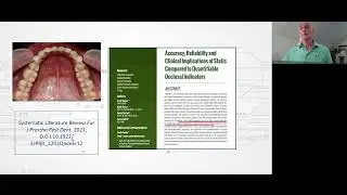 Zygomatic implants in oral rehabilitation 1 occlusal forces control in restorations on implants