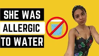 MINDBODY INTERVIEW: How CherelleThinks overcame Aquagenic Urticaria (Water allergy)