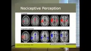 Behavioural, electrophysiological and imaging results in patients with disorders of consciousness