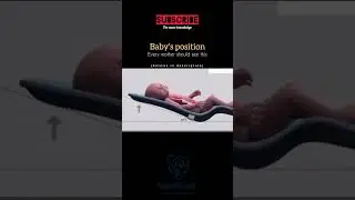 Best Baby Position After Feeding | Prevent Gas & Vomit👶🍼 #healthshorts #babyfeeding