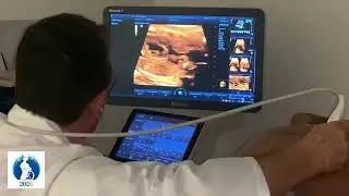 Ecocardiograma fetal.  #ecocardiogramafetal #unifetal #embarazo #regioncaribe #soledad #perinato