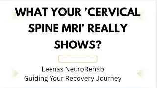 Cervical Spine-MRI#MedicalVideo#EducationalVideo#AnatomyExplained#MedicalContent#YouTubeLearning