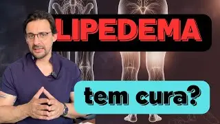 Lipedema tem Cura? | Dr. Jo&atilde;o Tassinary