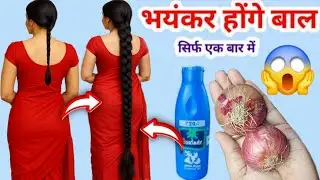 🌍World's Best Onion serum For Long Strong Silky Hair Only 3days😱#haircare#shampoo#viral#StopHairfall
