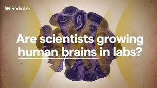 Brain Balls | Radiolab Podcast