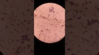 Enterococcus #ytshorts #shorts  #viral