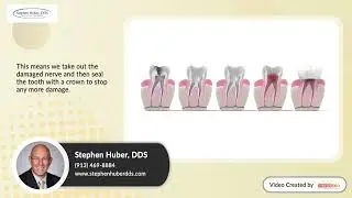 Can You Save a Broken Tooth? Dentist's Guide