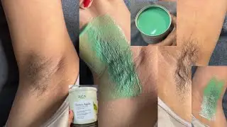 Best wax for sensitive skin/Armpit waxing by rica green apple wax #skincare #beauty #armpitwaxing