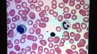 Blood Connective Tissue